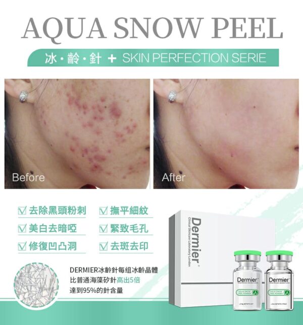 Dermier 冰齡針盒裝精華 6套 Aqua Snow Peel Powder 6Set：圖片 4